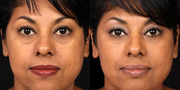 Cosmetic Surgery Wisconsin Helps You to Get Your Desired Looks